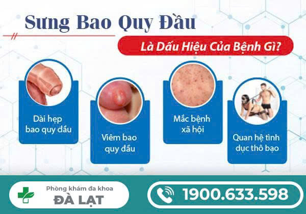 Hình ảnh minh họa